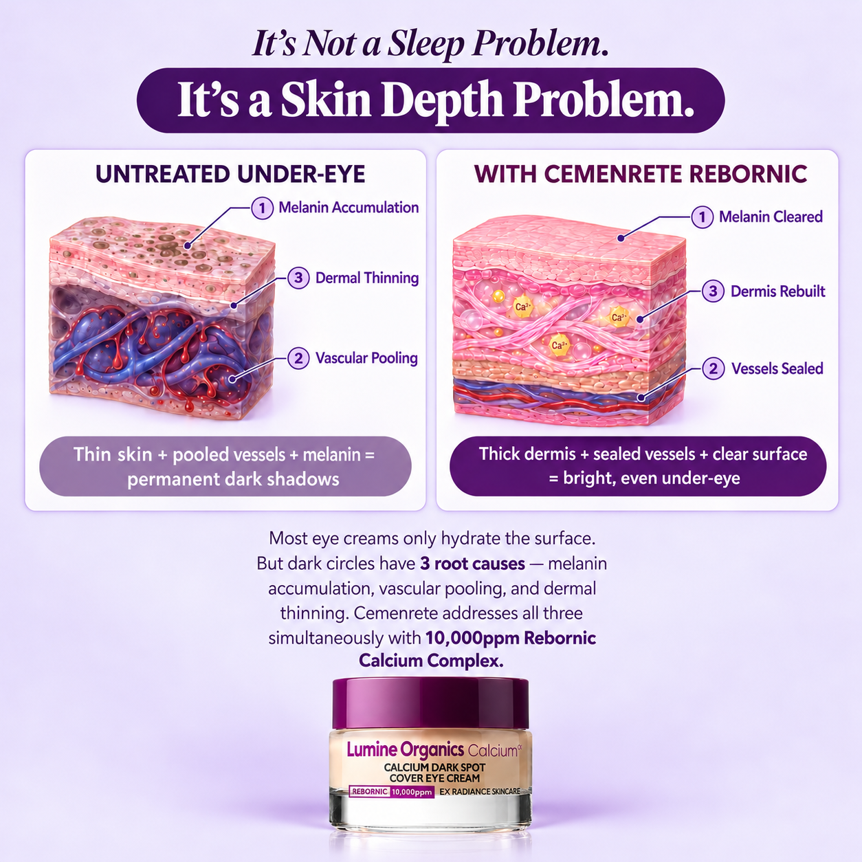 Cemenrete Calcium Advanced — Dark Circle Repair Eye Cream